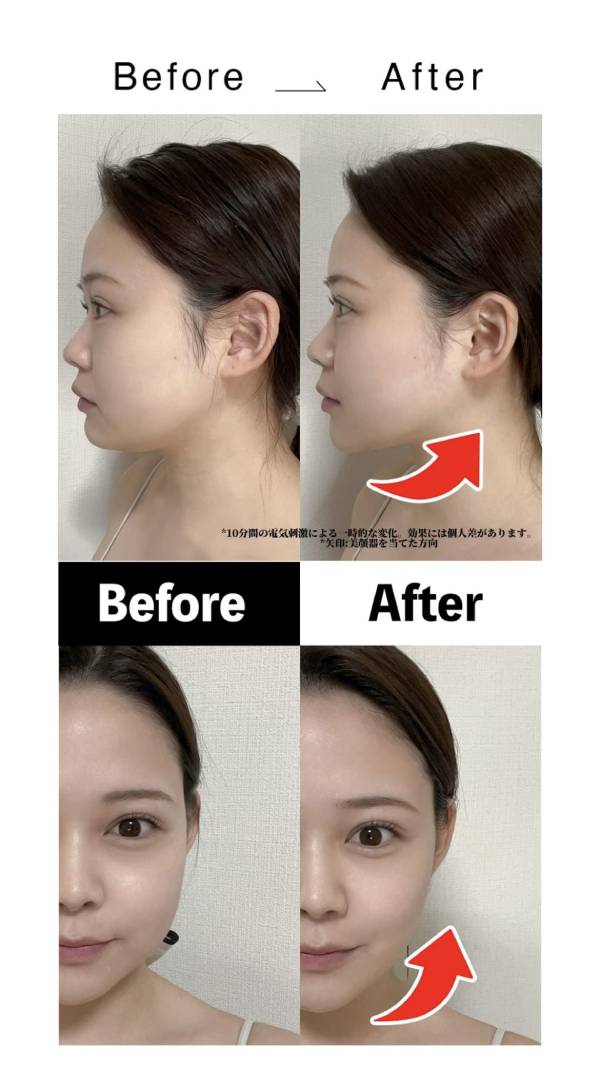 Brighte エレキブラシ プラスを使ったビフォーアフター