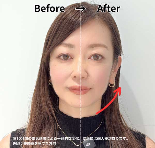 Brighte エレキブラシ プラスを使ったビフォーアフター