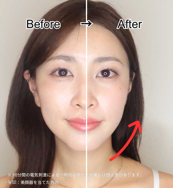 Brighte エレキブラシ プラスを使ったビフォーアフター