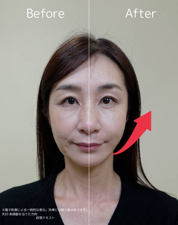 Brighte エレキブラシ プラスを使ったビフォーアフター